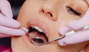 pulizia dei denti in gravidanza
